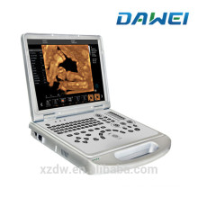 Portable ultrasound color doppler laptop 4d doppler ultrasound